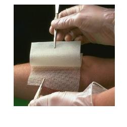 GARZA MEDICATA BACTIGRAS CON CLOREXIDINA ACETATO 0,5% 10X10CM 10 PEZZI - Newepa Srl